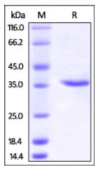 Human CA9, His Tag on SDS-PAGE under reducing (R) condition. The gel was stained overnight with Coomassie Blue. The purity of the protein is greater than 95%.
